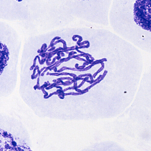 Onion cell during prophase